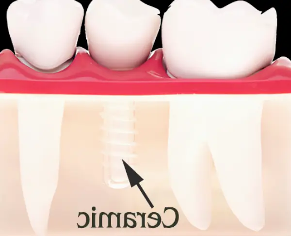 Ellicott City Julian Center for Dental Implants