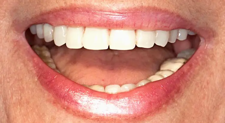 San Rafael Alex Frade, DDS