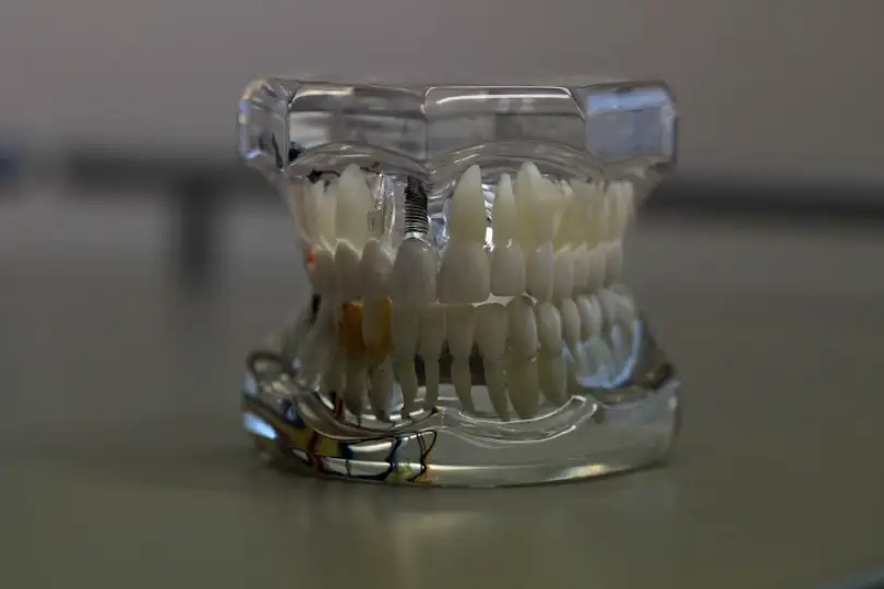 Affordable Dentist Near Me - Grand Prairie