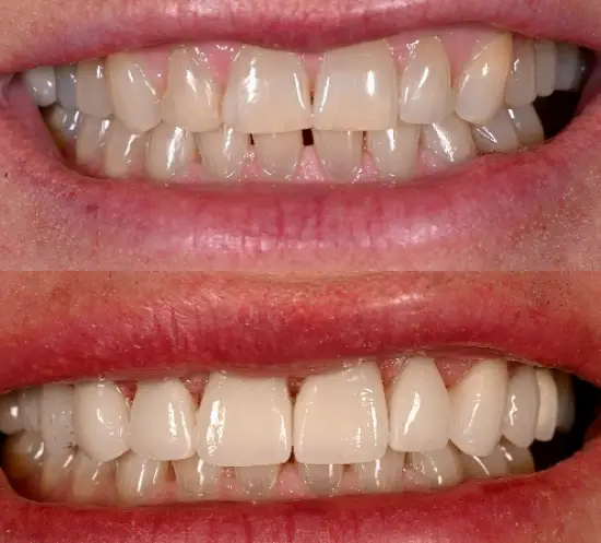 Colonia Dental Associates - Woodbridge