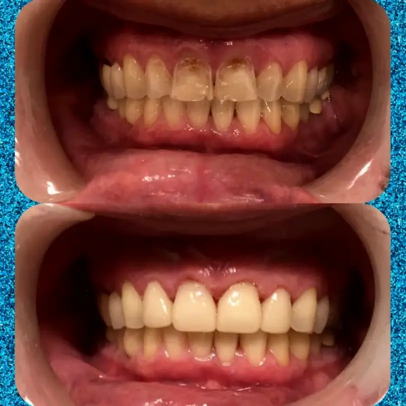 Falcon Just For Grins Kids and Family Dental and Orthodontics