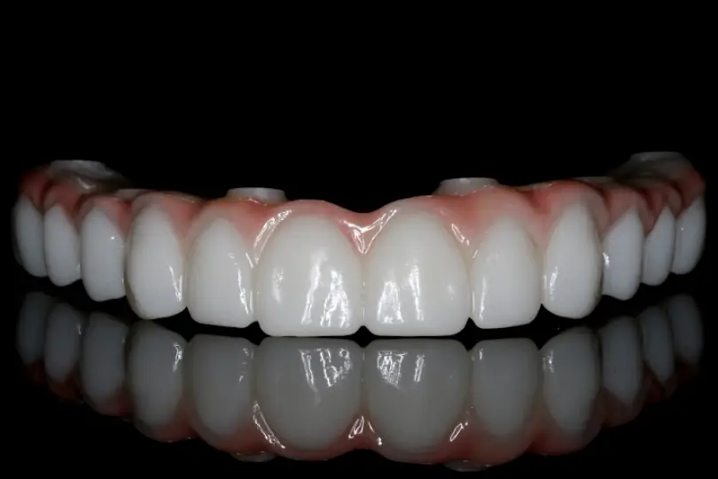 Columbia Falls Three Rivers Dental - Cosmetic, Implants & Dentures