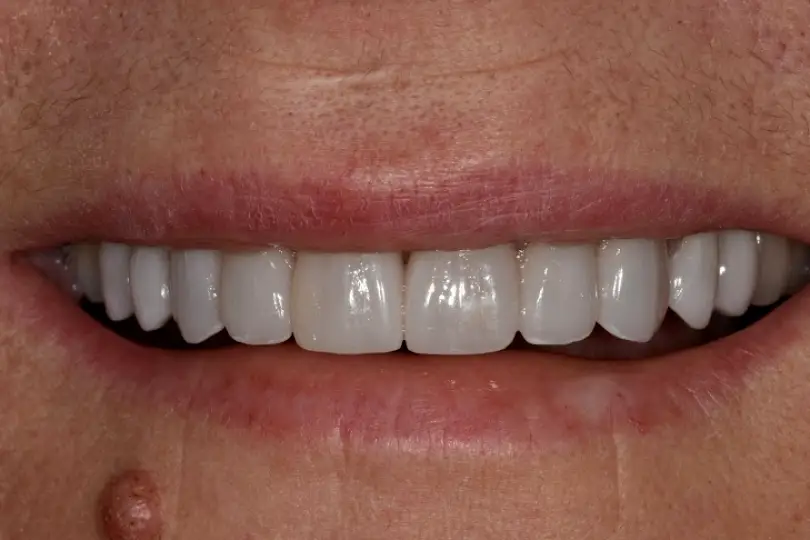  Farmington Hills Richard S. Bernstein DDS