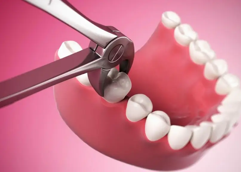 Sunrise Dental Yakima