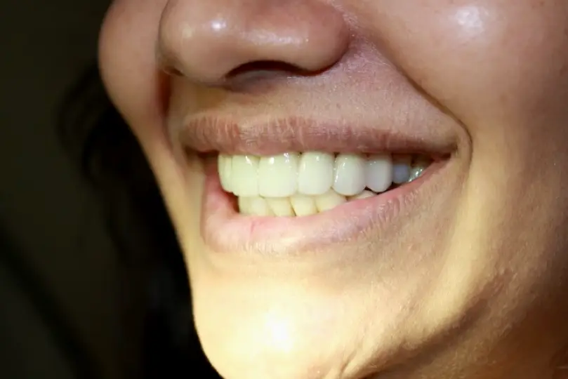 Nutley Dr. Thomas Torre DMD {Family, Cosmetic and Implant Dentistry }
