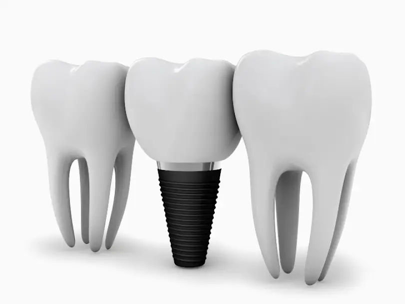 Reseda Five Star Family Dental - Dr. Vahe Vorperian D.D.S.