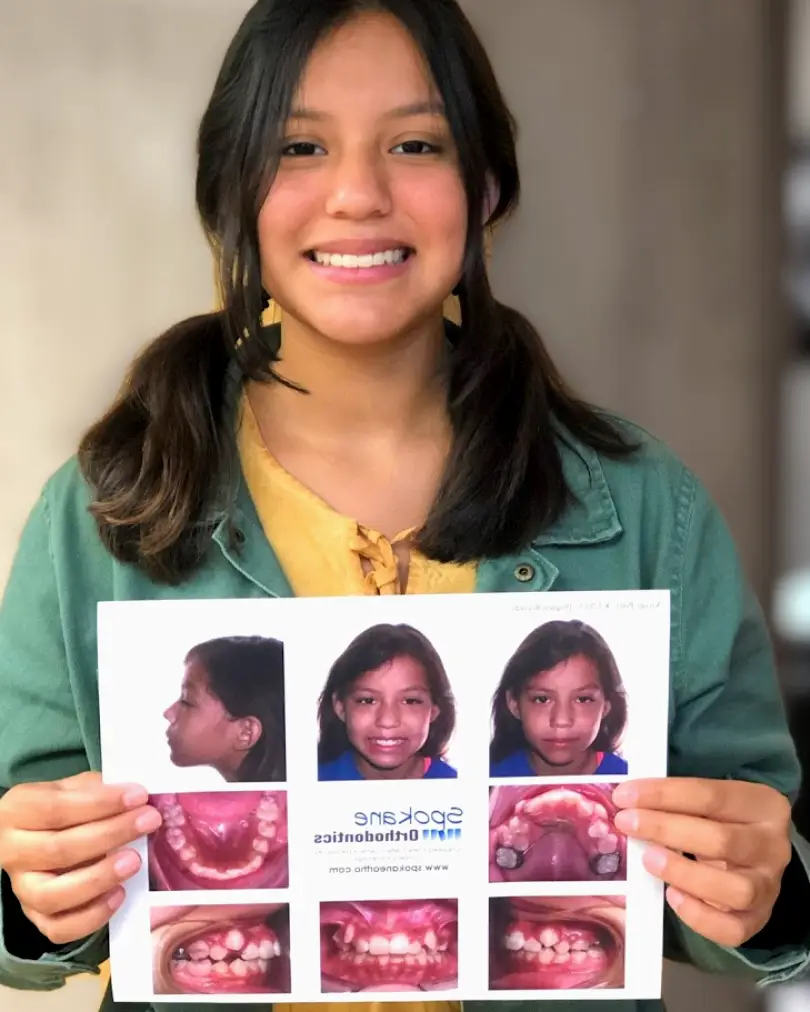 Beaver Falls Spokane Orthodontics