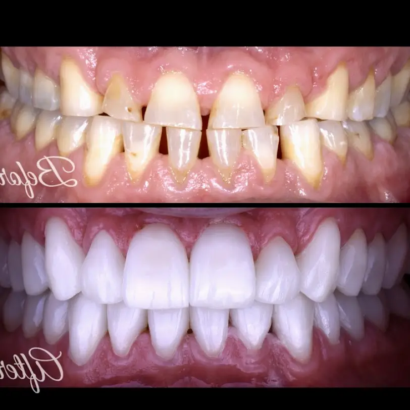 Los Algodones Simply Dental