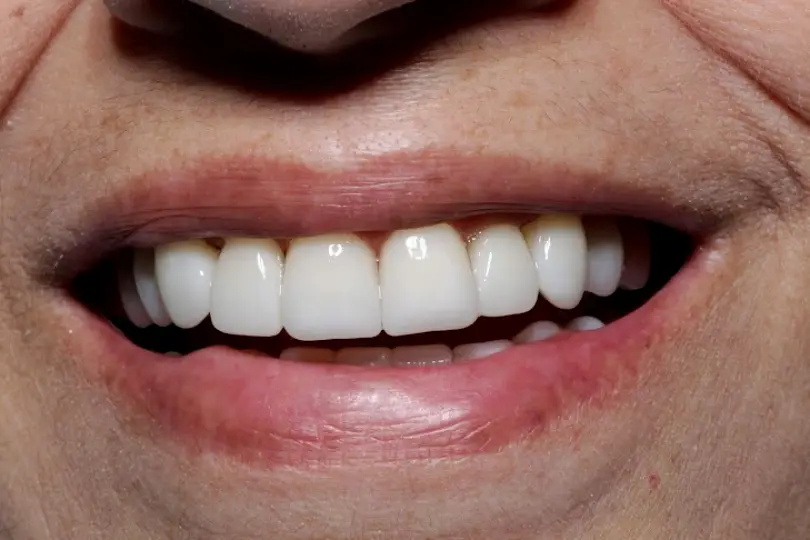 Dr. Estrada - Cosmetic Dentistry Nuevo Progreso.