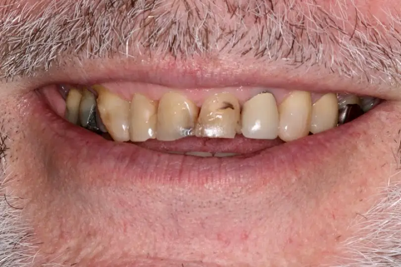 Texarkana Patterson Dental Center