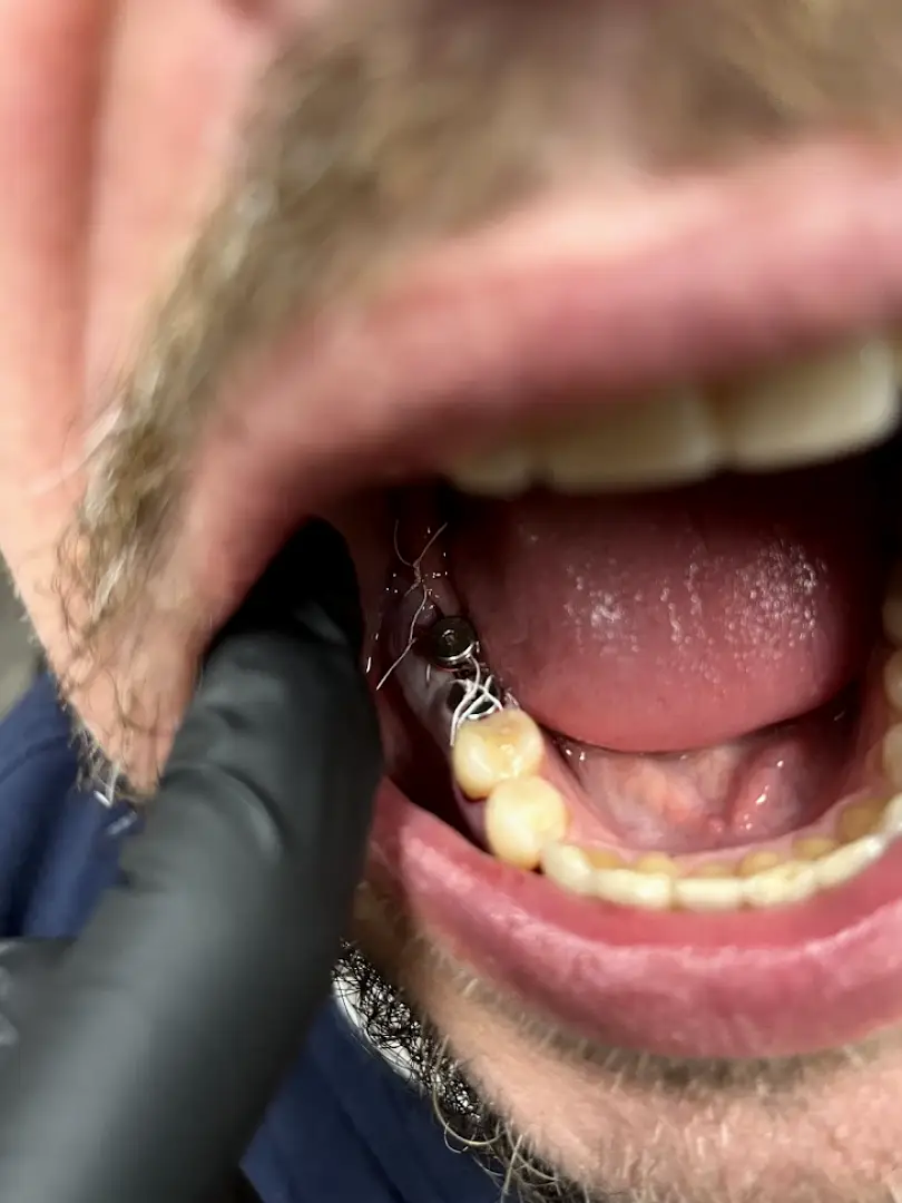 Issaquah AirSync Integrative Dentistry