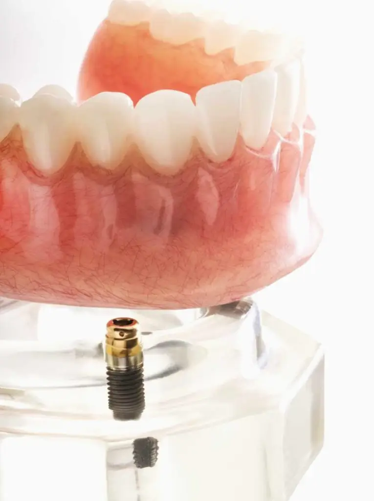 Sweet Comfort Dentures of Port Orange