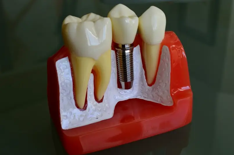 Lathrup Village Fortson Dental Implant Center