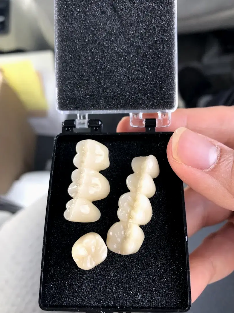 Santa Ana Mobile Care Dentistry