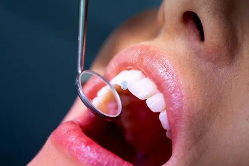 Thermopolis Paintbrush Dental