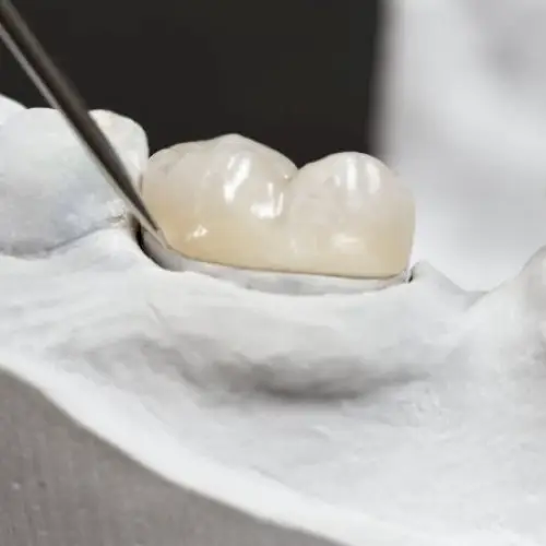 Idaho Falls CMR Dental Lab