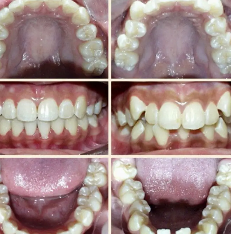 Mason Johnson Orthodontics