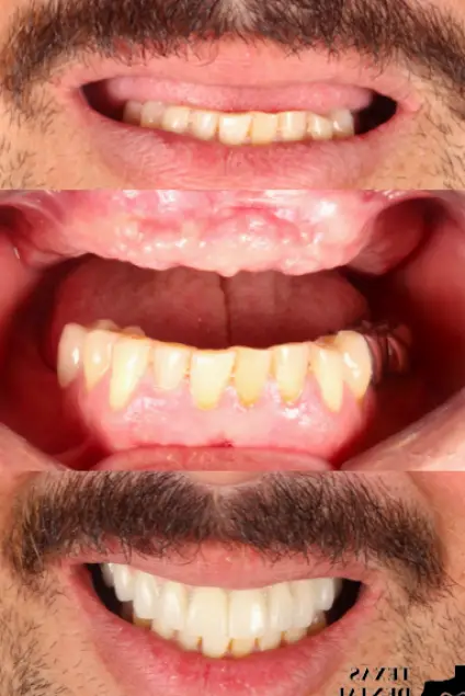Nuevo Progreso Texas Dental Clinic - implant & cosmetic dentistry