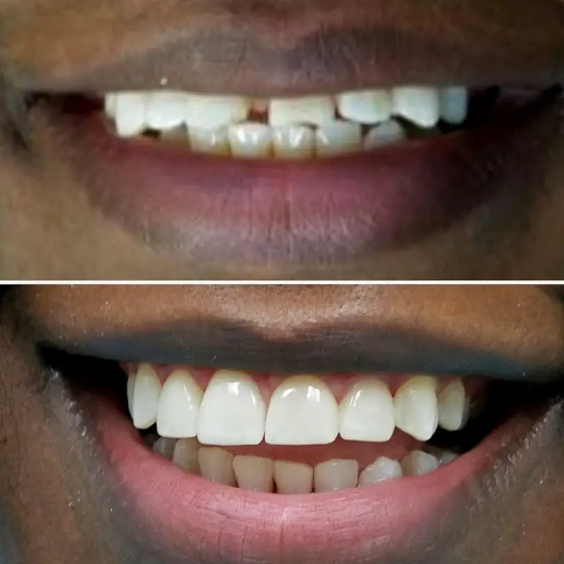  Chicago Happy Smiles Dental Office (Office of Dr. Alicia D. Franklin, DDS)