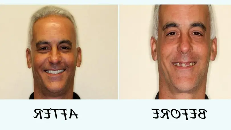 Clermont Dentures & Dental Implants by Dr. Mohammad Kasem, B.D.S.