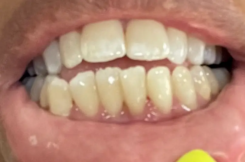 Metairie Periodontal Health Specialists, LLC