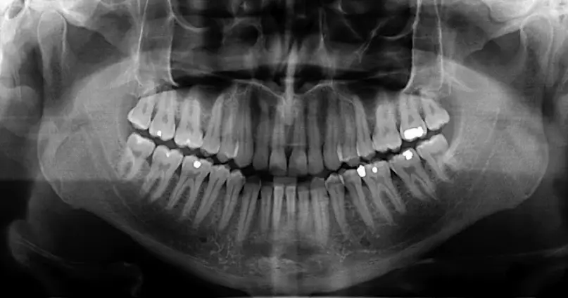 Southbridge Central New England Oral and Maxillofacial Surgery