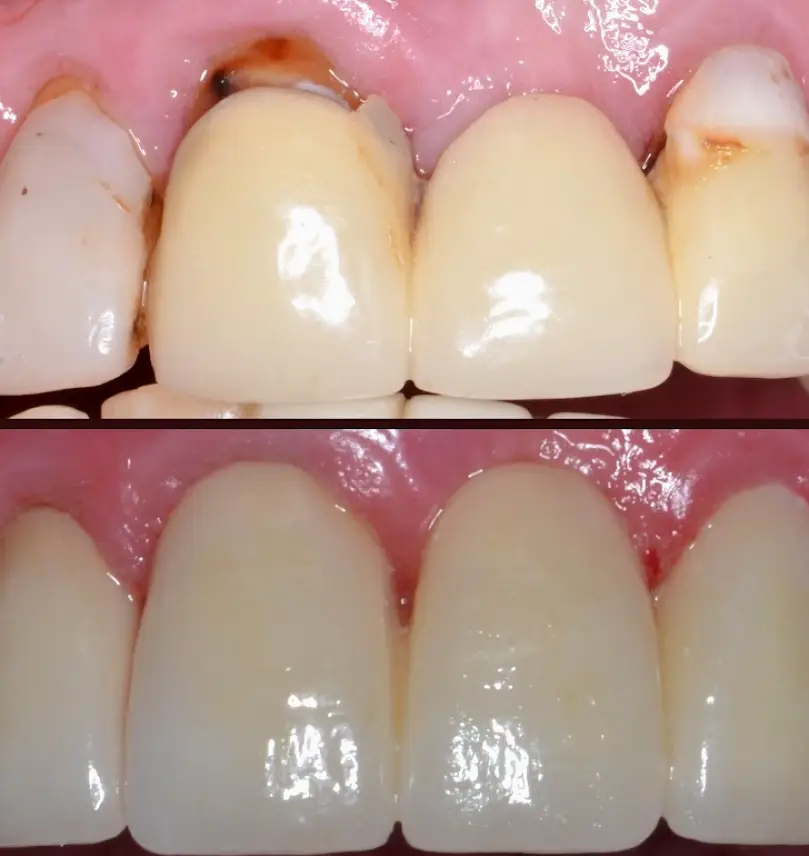 Woodland Smiles 4U Dental