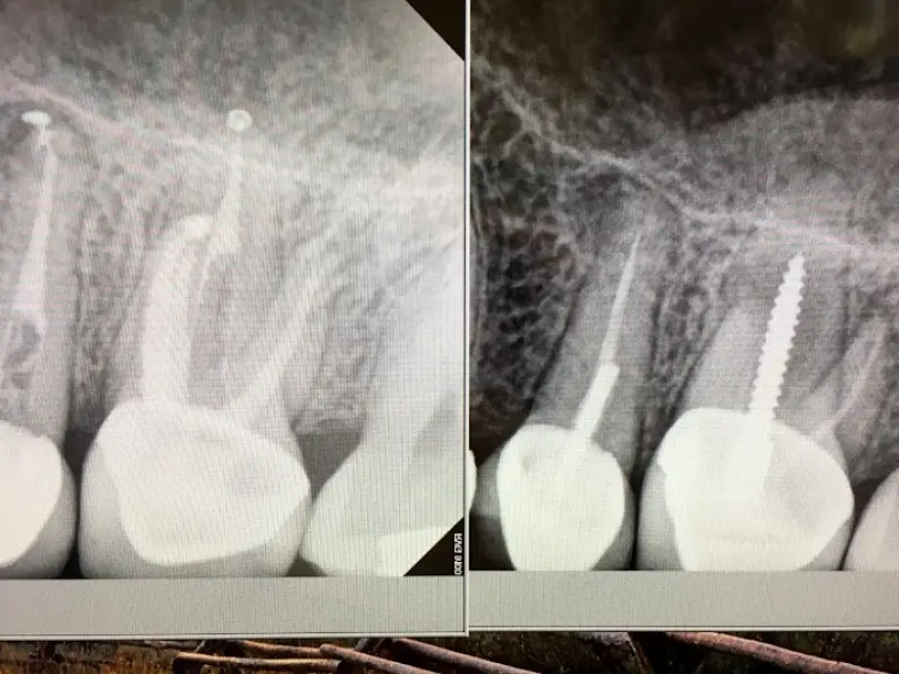 Meridian Rocky Mountain Endodontics