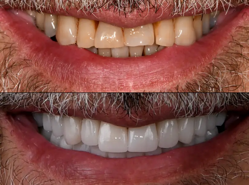 Garwood Bender & Todaro Family Dental