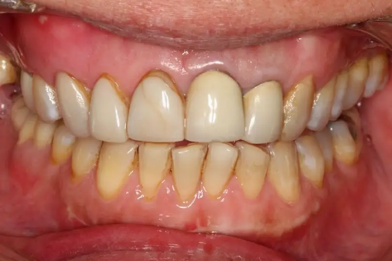 New Hyde Park L & L Dental Associates