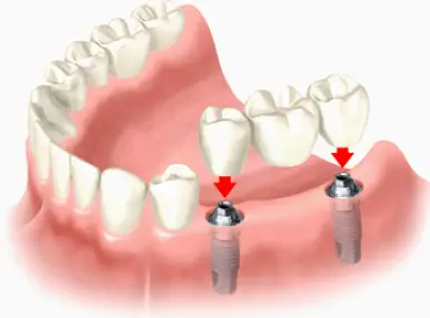 Southampton Pennsylvania Center for Advanced Dentistry - Dr. Olga Shvarts