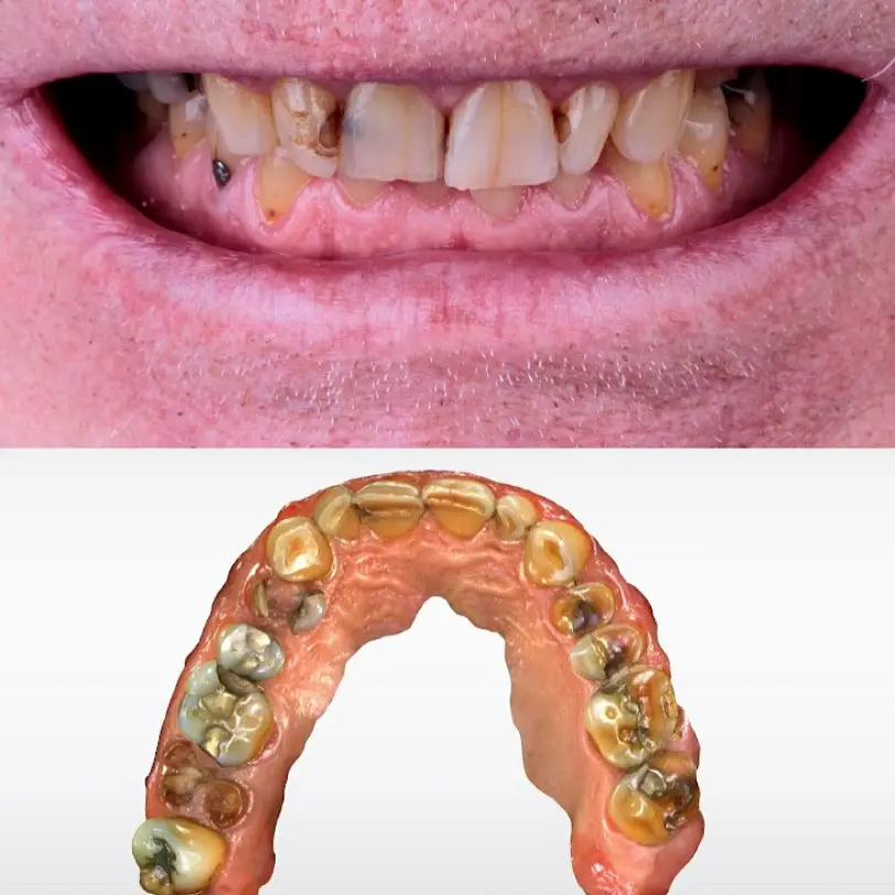 Tijuana PACIFIC DENTAL TIJUANA