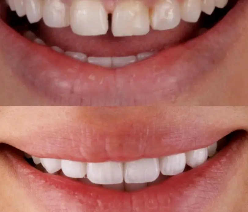 Canton A+ Dentistry