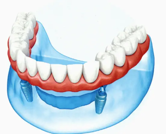  Charlottesville Hillview Dentures and Implants
