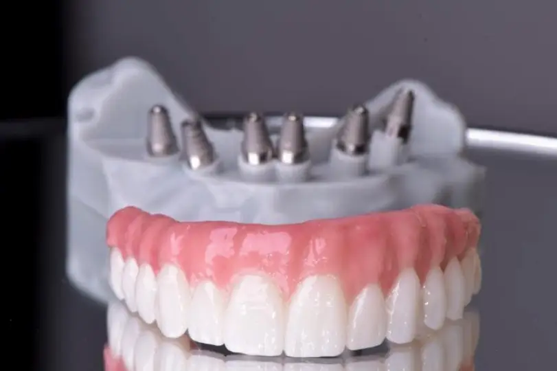  Hollywood Upper Dental