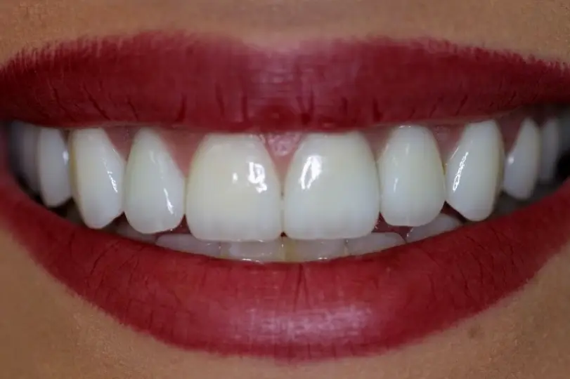 Redlands Mini Dental Implant Center