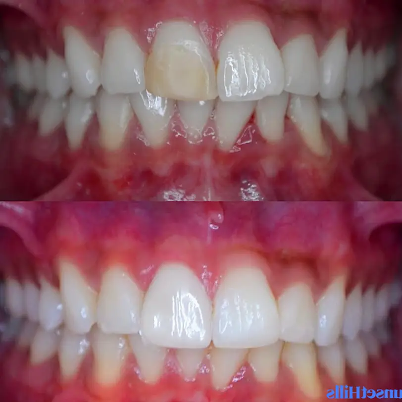  Austin Mark Castor - Sunset Hills Dentistry