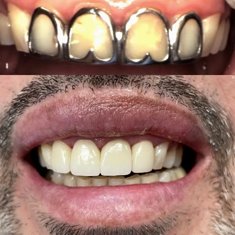 Bell Dental and Implant Care Center