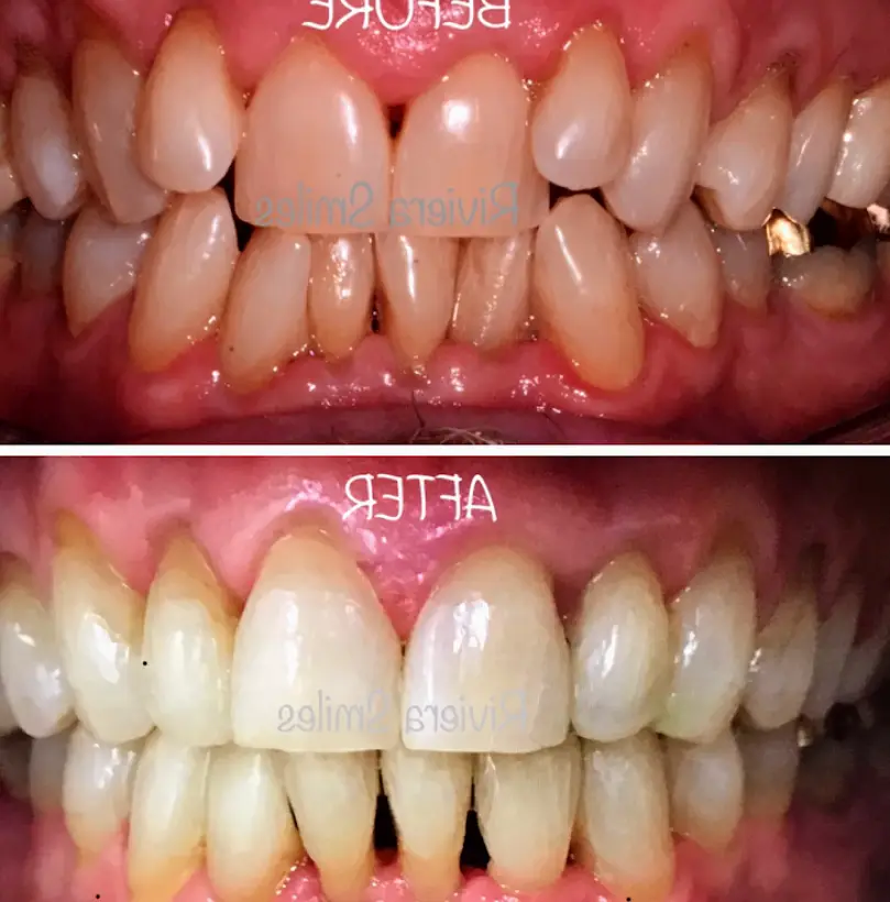 Carpinteria Riviera Smiles - Santa Barbara Dentist - Dr. Ana Martinez