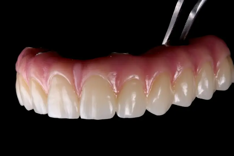 Kenilworth ID Dental Lab