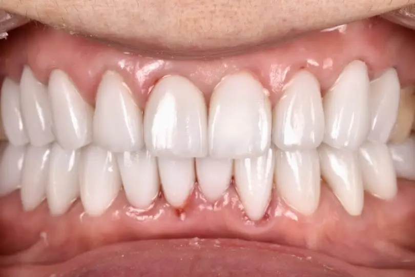 Hacienda Heights Pristine Dental Service