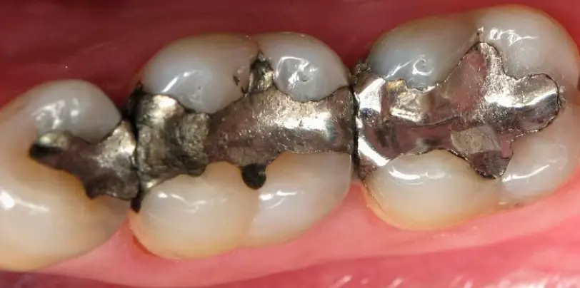 Sumiton Dental