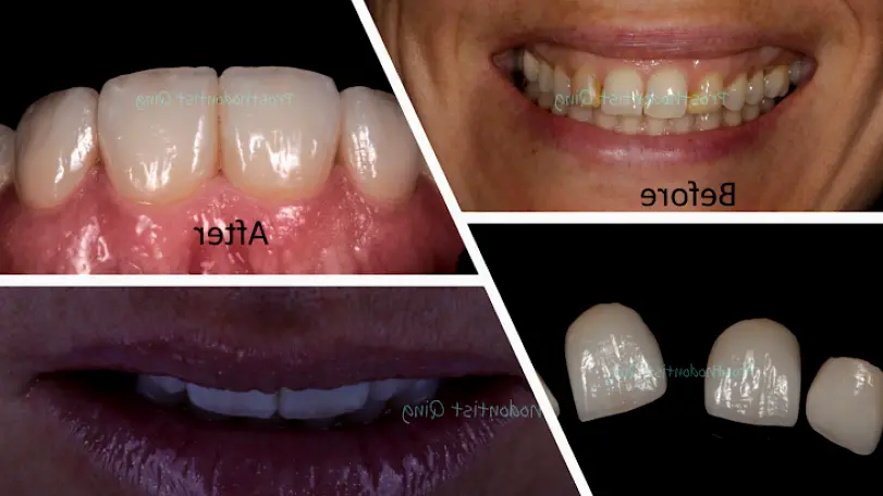 Lansdale Bucks Dental Health and Esthetics: Hai Qing, DMD, Ph.D., Prosthodontist