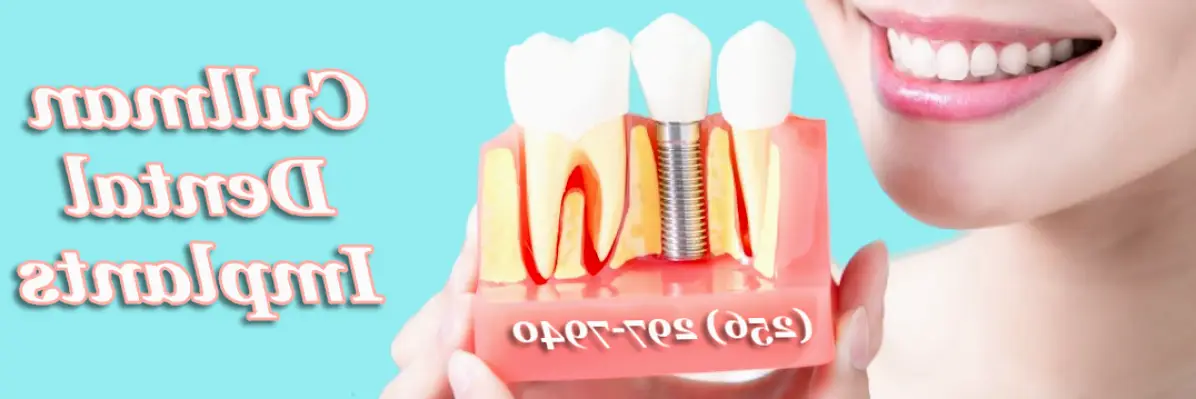 Cullman Dental Implants