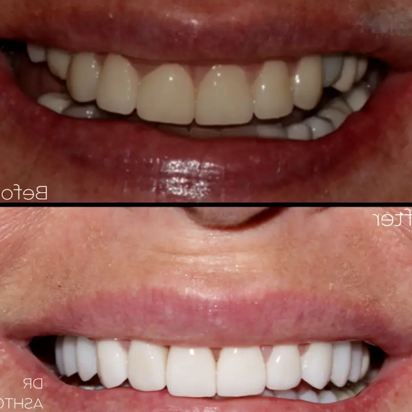  Delray Beach Coastline Dental Implants
