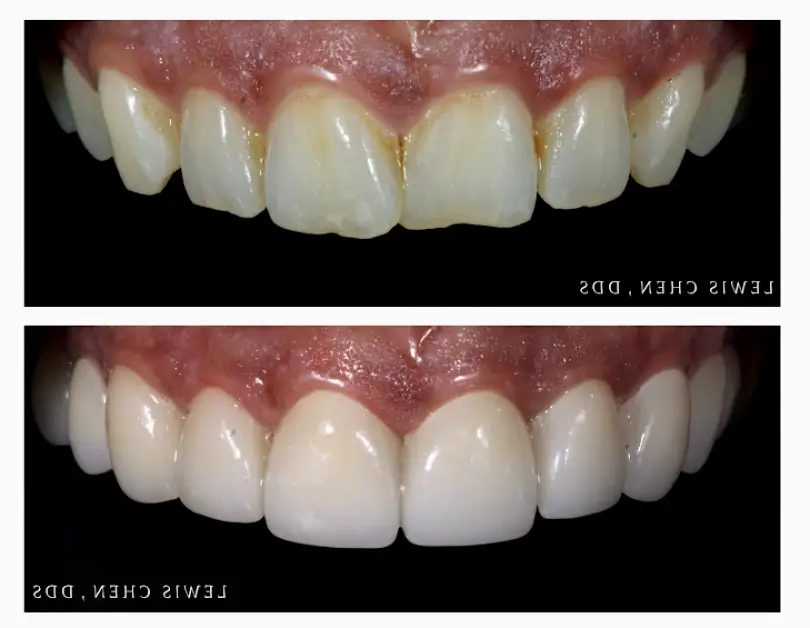 Edgewater Beam Dental