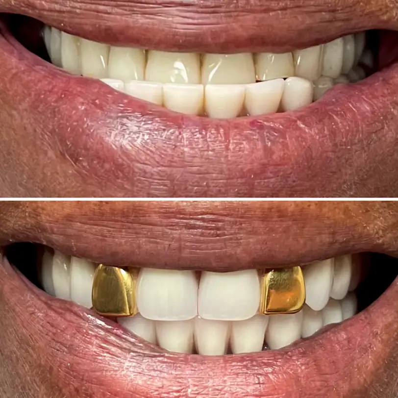 Vida Dental Buda