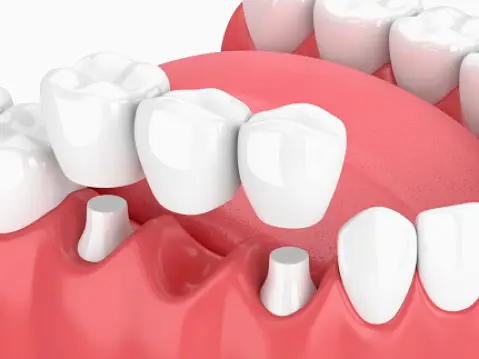 Warren Wendy Sanger DMD Cosmetic & Family Dentistry