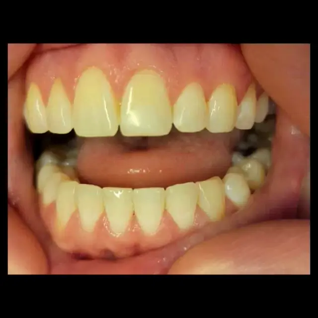 Occoquan Historic District Eclipse Teeth Whitening & Gems