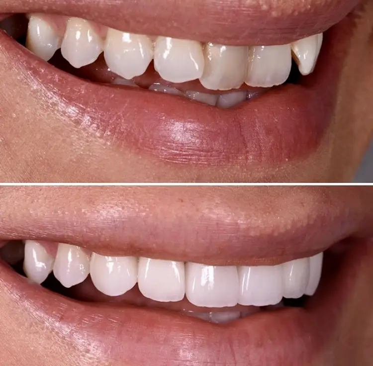 Coronado Smiles Dental